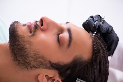 hair-restoring-male