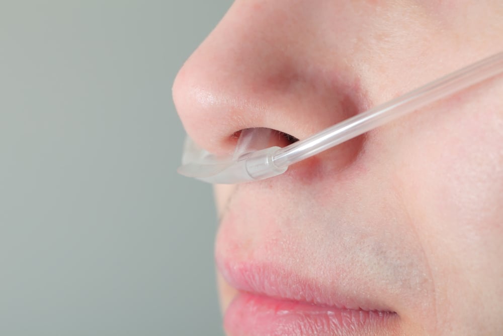 Nasal Ozone Insufflation